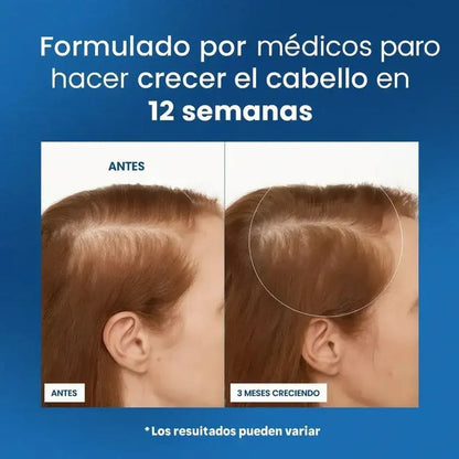 Serum Bodywise Crecimiento Y Fortalecimiento Capilar Roll-On