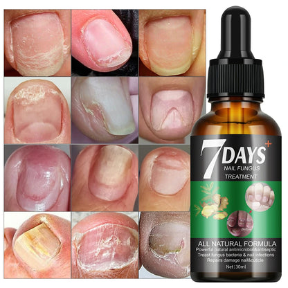 Tratamiento Aceite Jengibre 7 Days Fortalecedor De Uñas x4