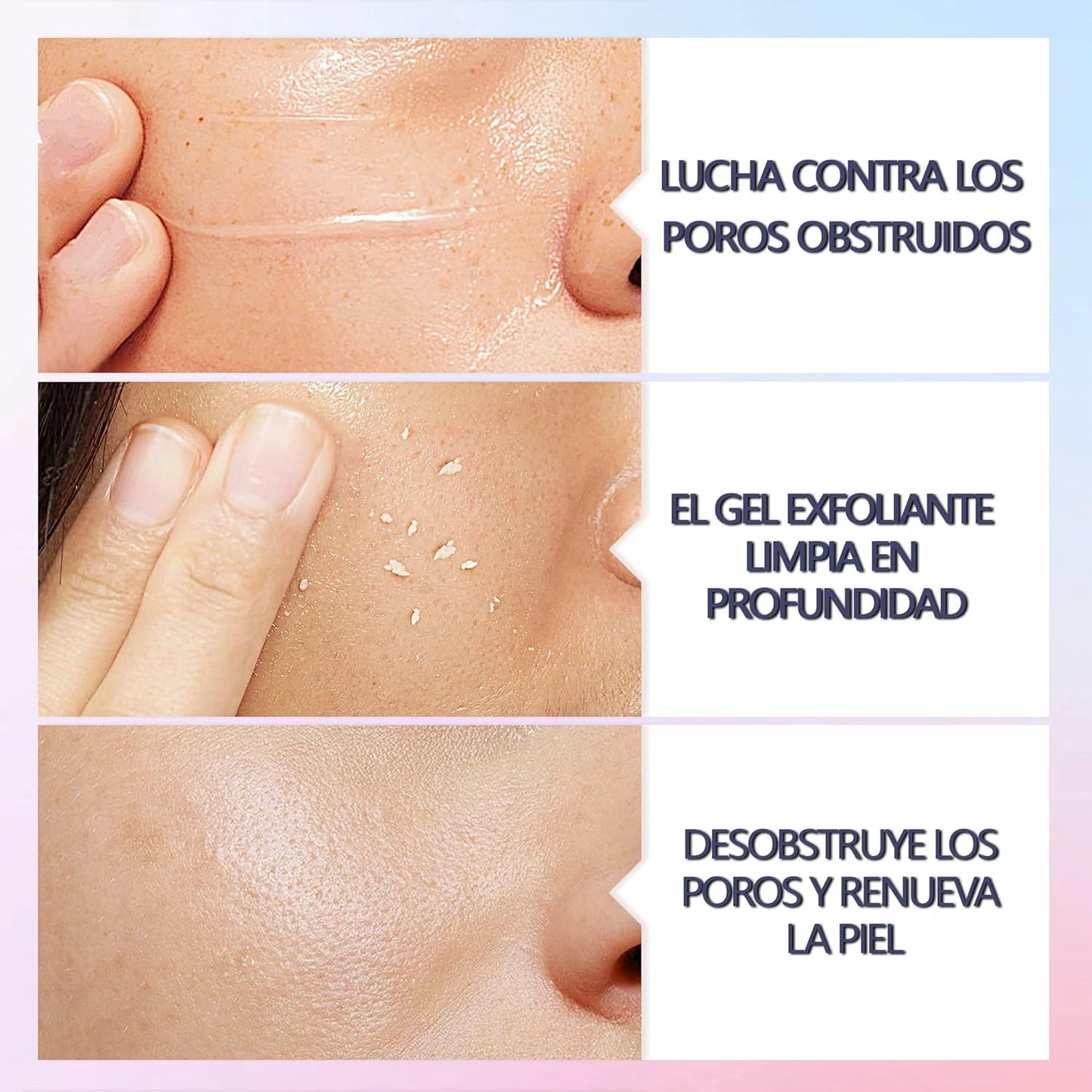 Gel Limpiador Facial Exfoliante Y Purificante Quarxery Pague 1 Lleve 2