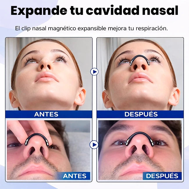 Kit Dilatador Nasal Magnético Anti Ronquidos