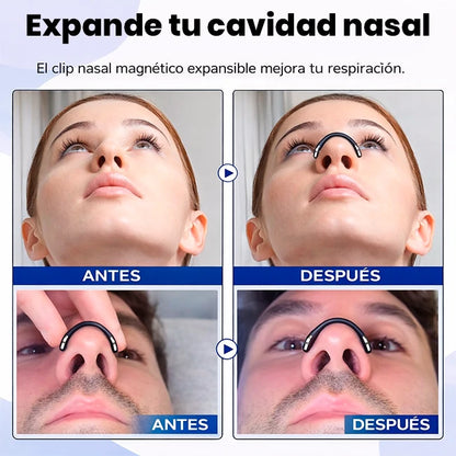 Kit Dilatador Nasal Magnético Anti Ronquidos