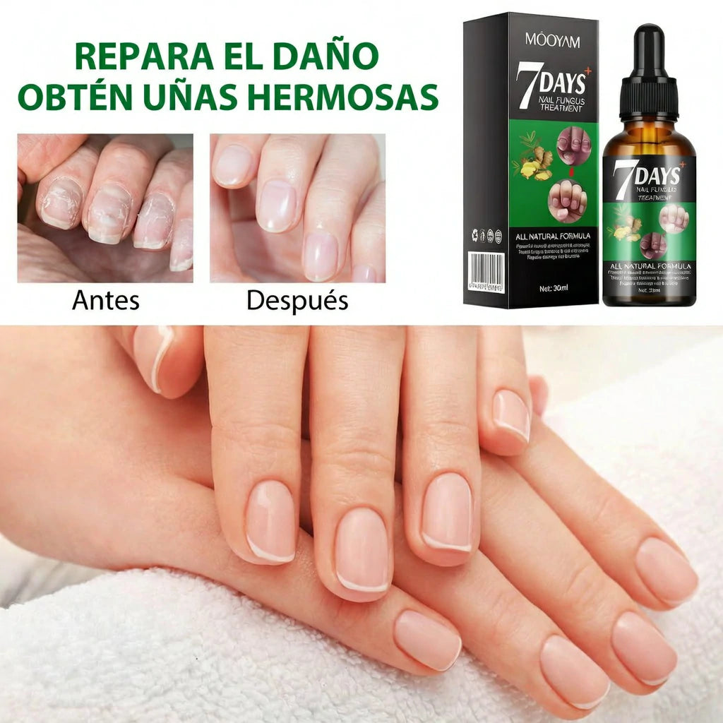 Tratamiento Aceite Jengibre 7 Days Fortalecedor De Uñas x4