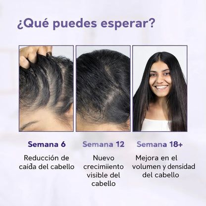 Serum Bodywise Crecimiento Y Fortalecimiento Capilar Roll-On