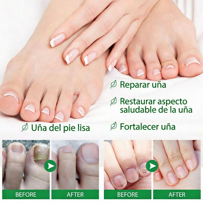 Tratamiento Aceite Jengibre 7 Days Fortalecedor De Uñas x4